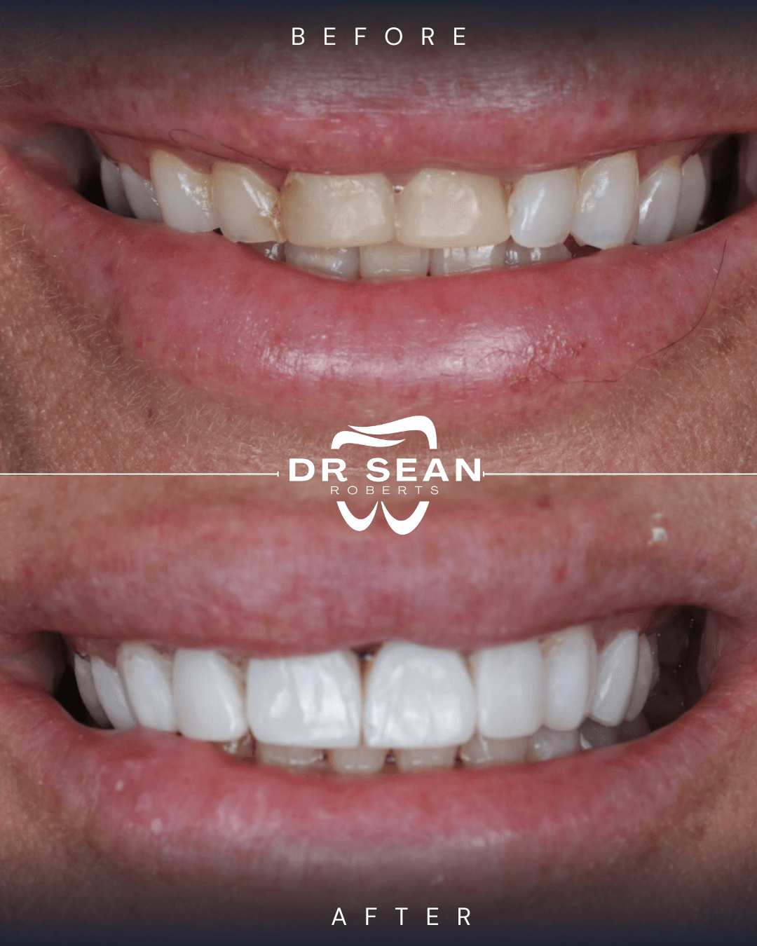 Smile transformation 2