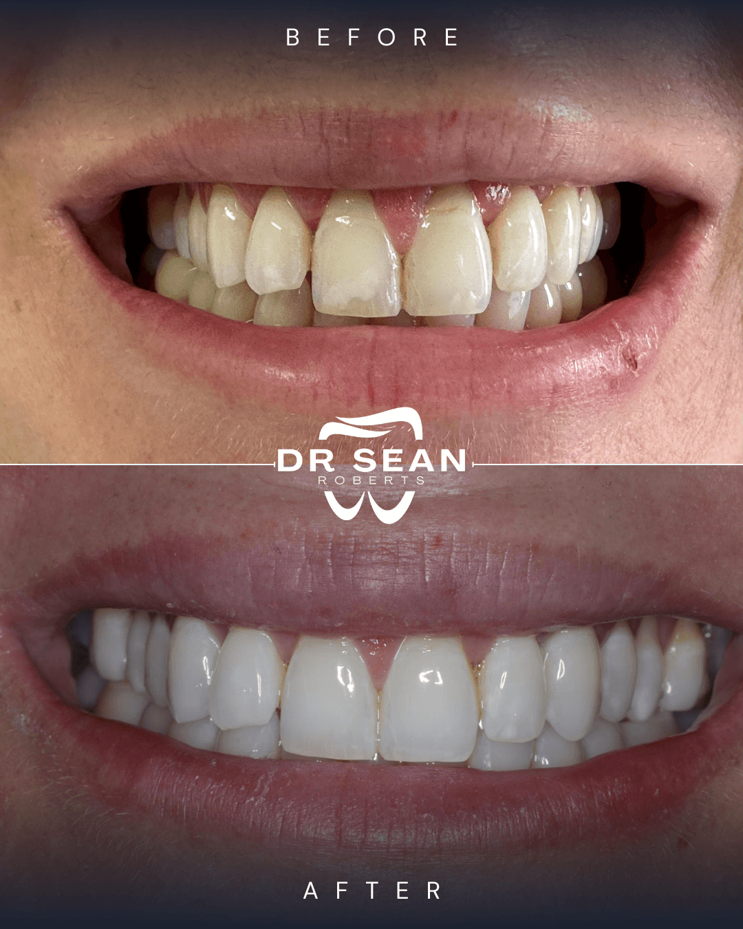 Smile transformation 11