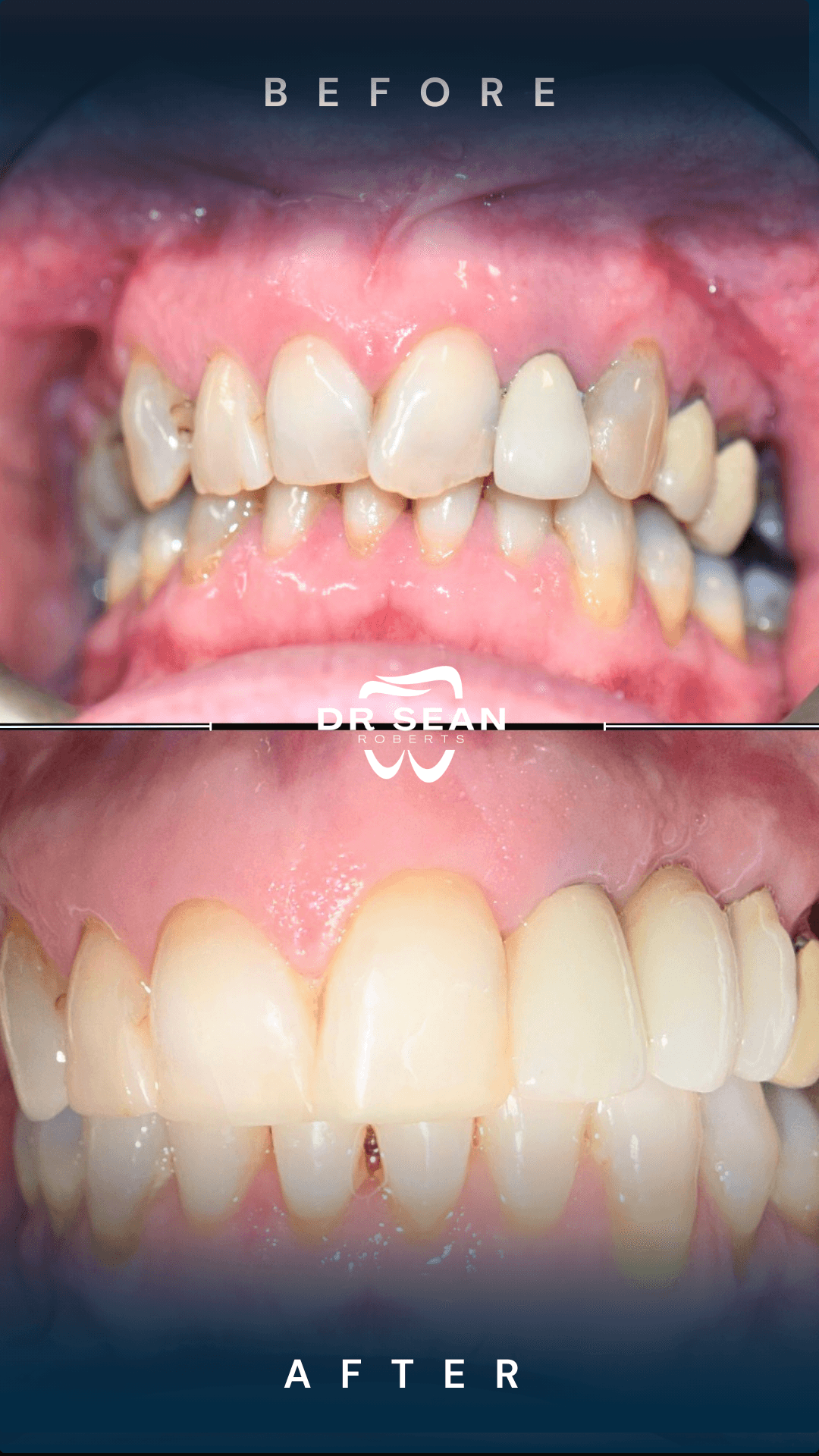 Smile transformation 5