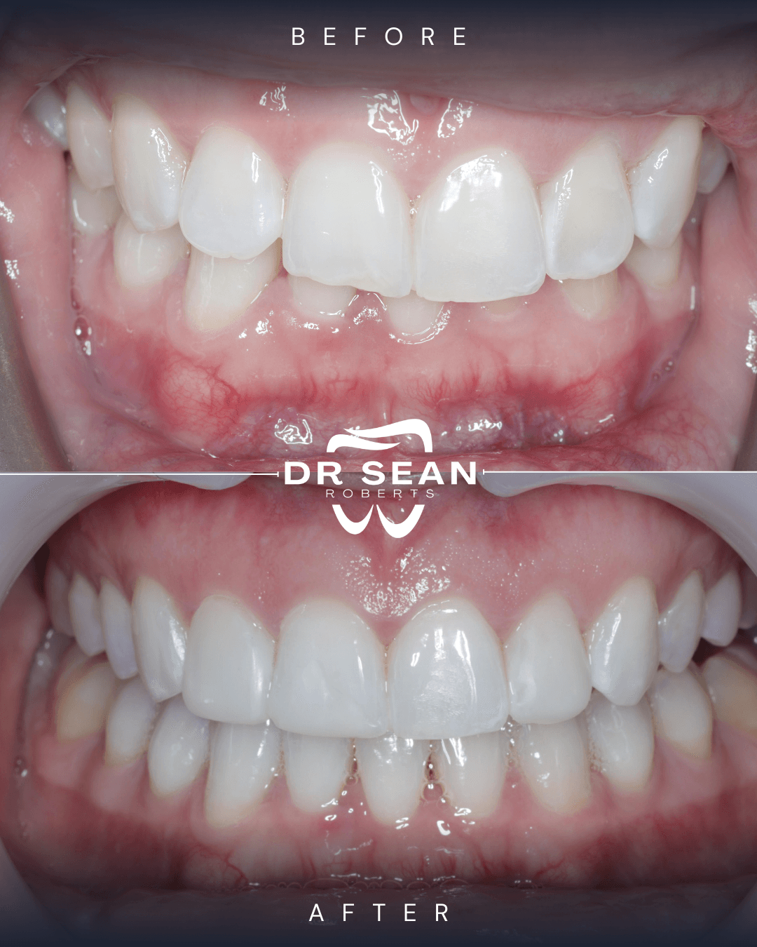 Smile transformation 8