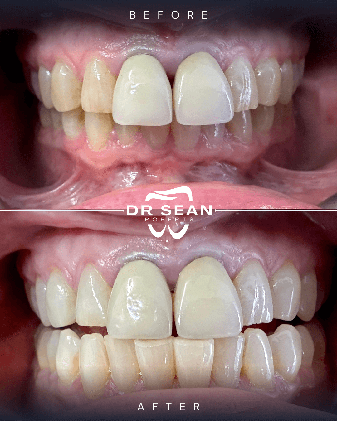 Smile transformation 9