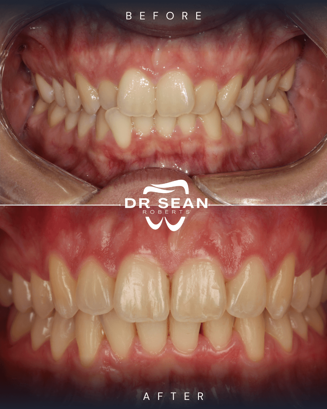 Smile transformation 10