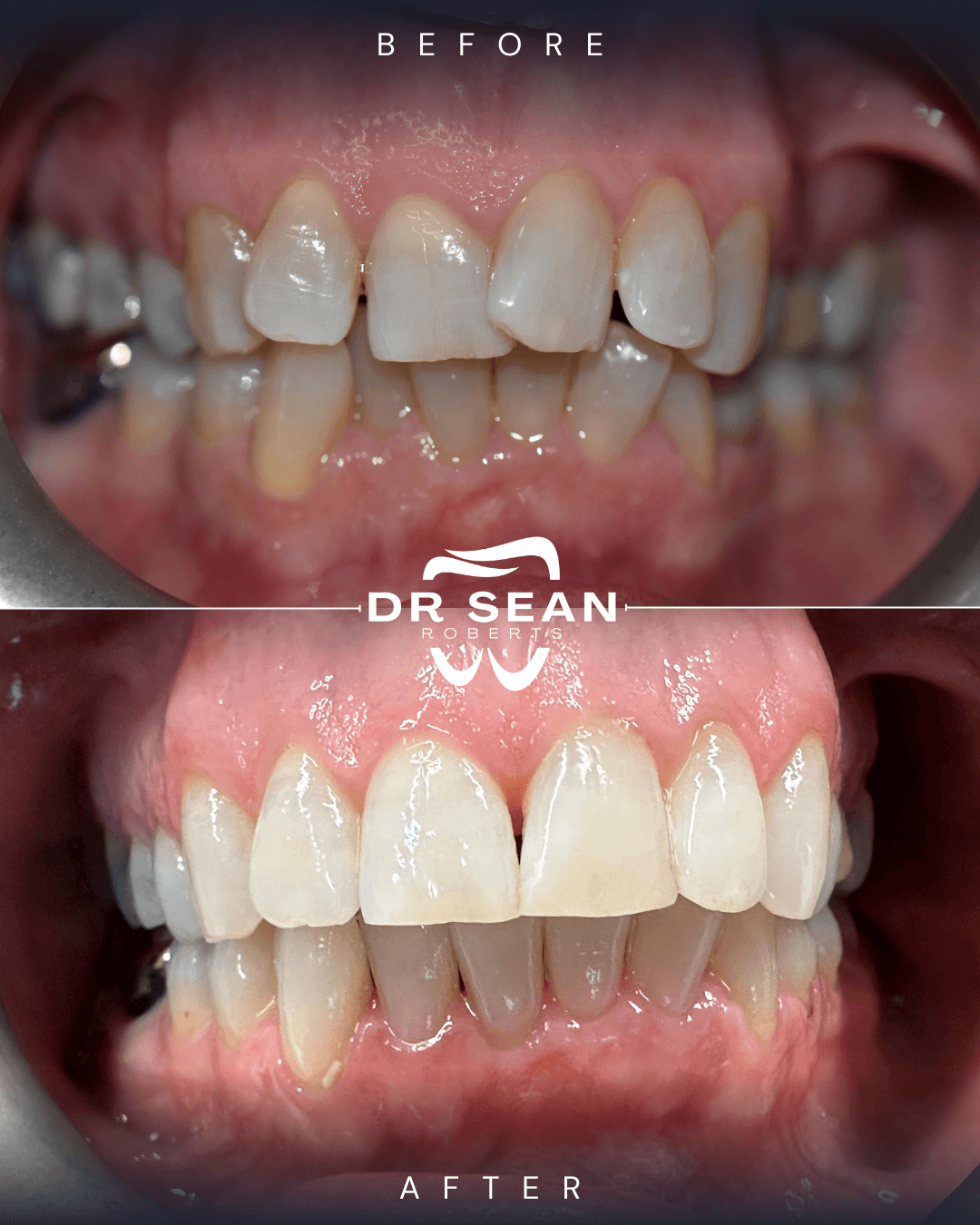 Smile transformation 7