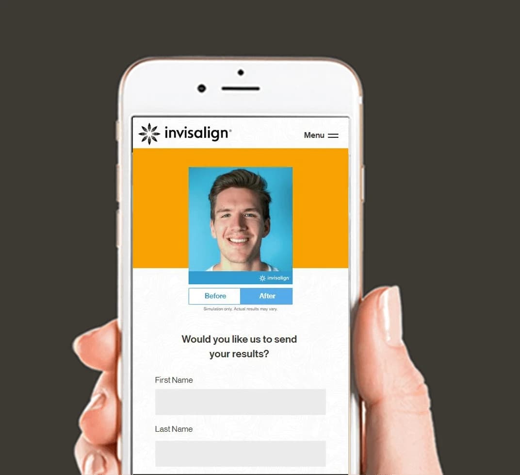 Invisalign Smile view